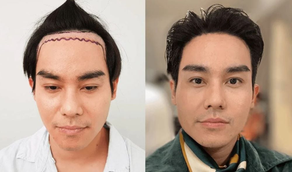 คุณจ๊ะ อธิศ อมรเวช (มือกีต้าร์ วง THE MOUSSES)