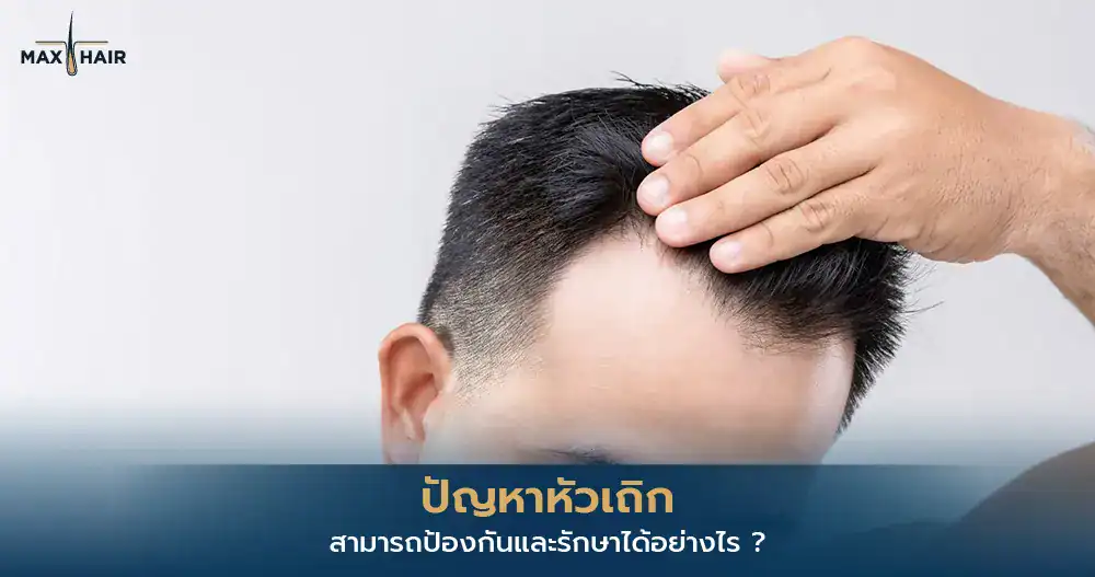 หัวเถิก