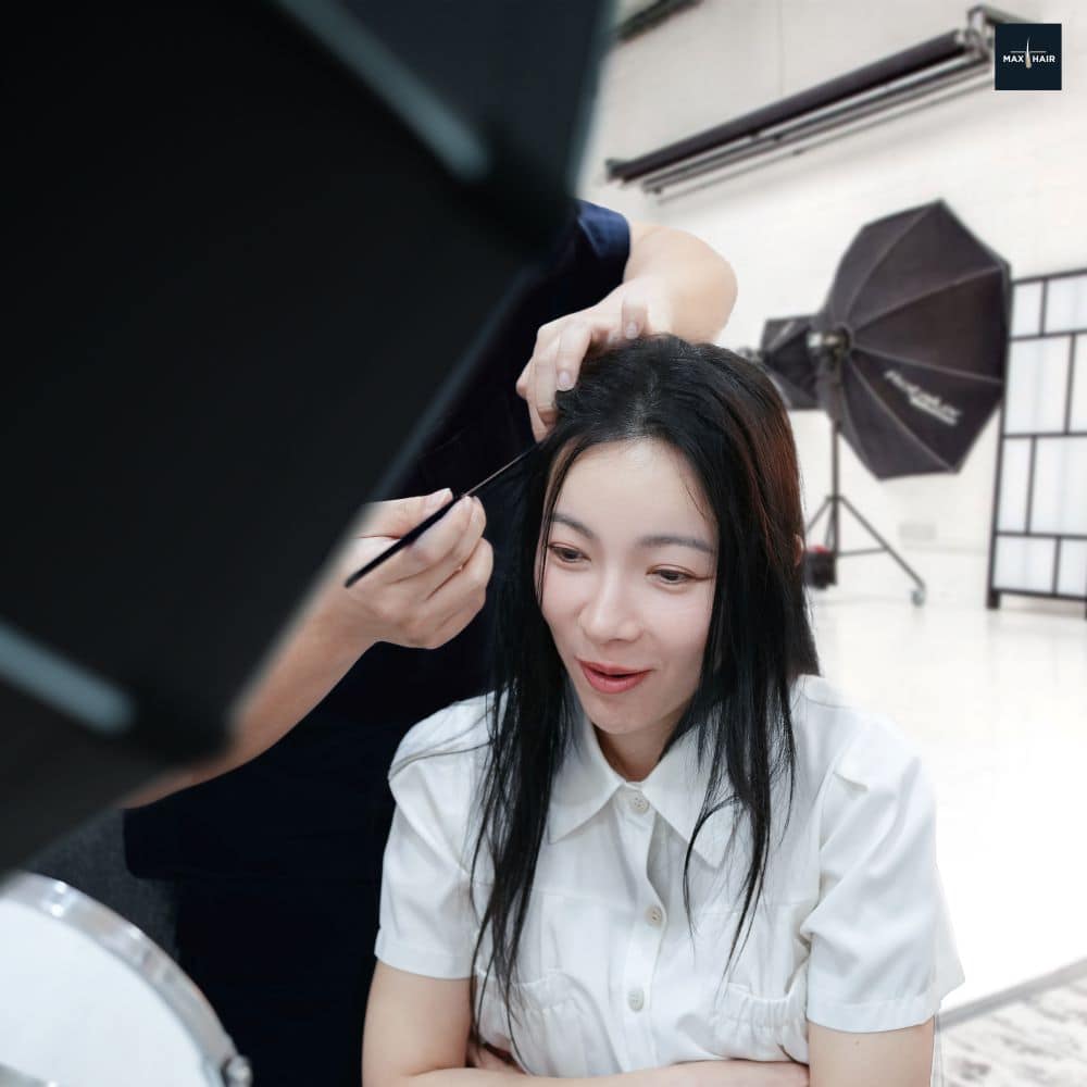 การปลูกผมด้วยเทคนิค Long Hair ทำให้สามารถใช้ชีวิตประจำวันต่อได้อย่างสะดวก