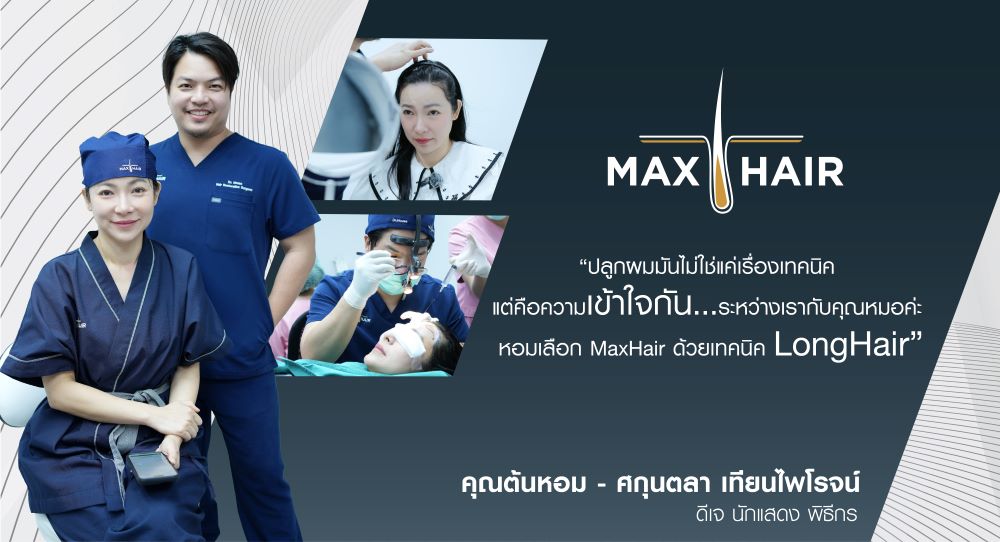 การรีวิวปลูกผมด้วยเทคนิค Long Hair โดยคุณต้นหอม ศกุนตลา