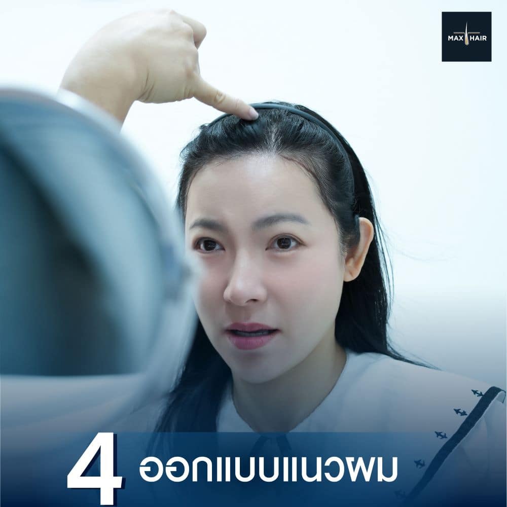 ขั้นตอนที่สี่ของการ Long Hair Transplant คือการออกแบบแนวผม
