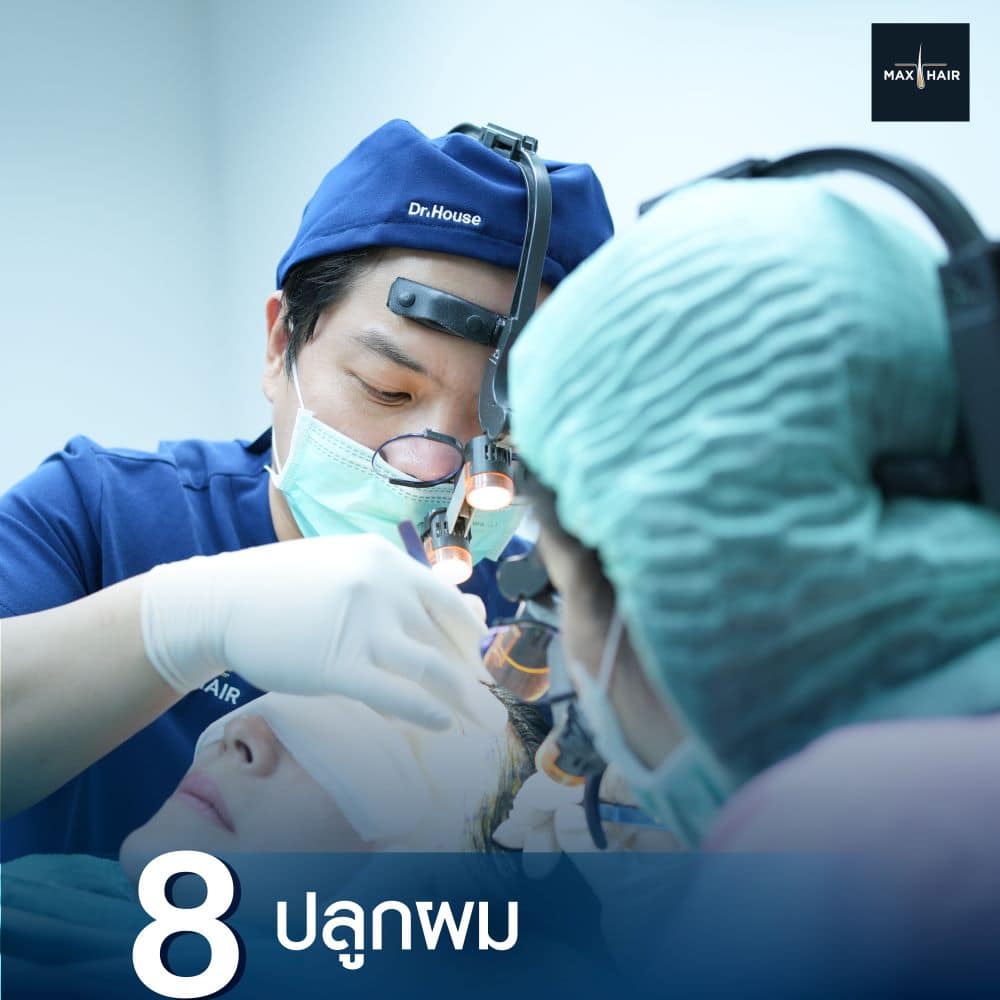 แพทย์ทำการปลูกผมหลังพักเบรกเสร็จ