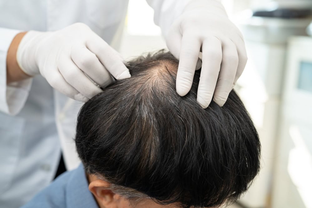 แพทย์ทำการเปรียบเทียบเทคนิคปลูกผมที่เหมาะกับปัญหาคนไข้