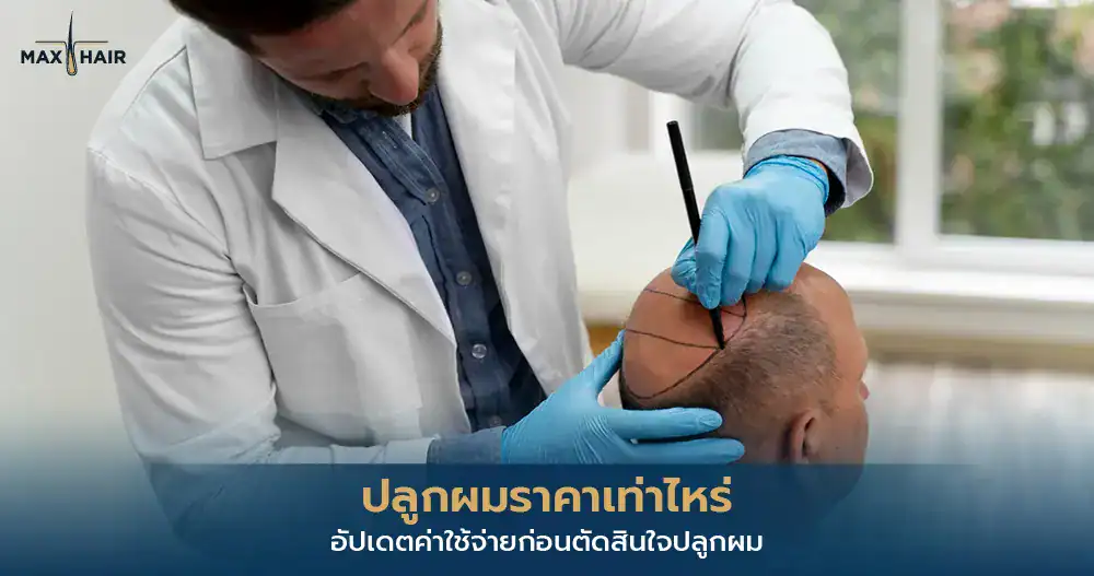 ปลูกผมราคาเท่าไหร่